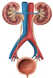 腎盂輸尿管連接部梗阻