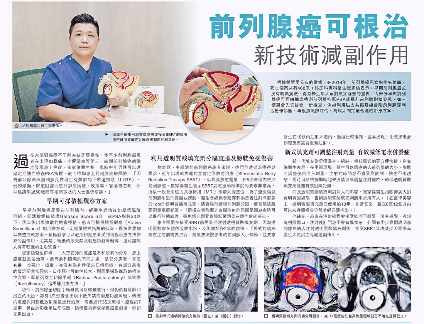 經會陰注射加隔直腸方案諮詢